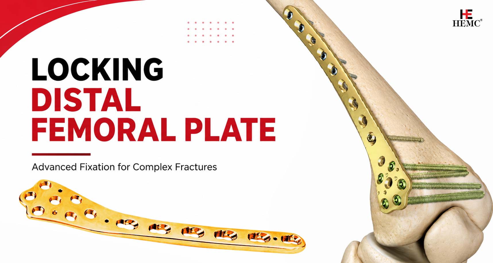 Locking Distal Femoral Plate: Features & Benefits Locking Distal Femoral Plate