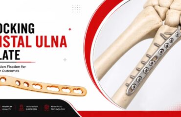 Locking Distal Ulna Plate - Complete Guide Locking Distal Ulna Plate for Wrist Fracture Fixation