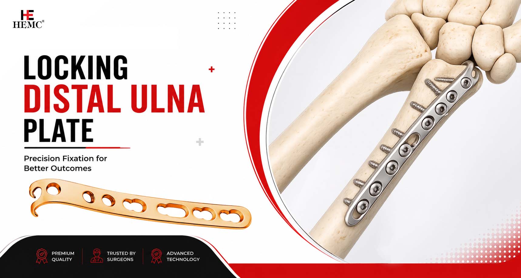 Locking Distal Ulna Plate for Wrist Fracture Fixation