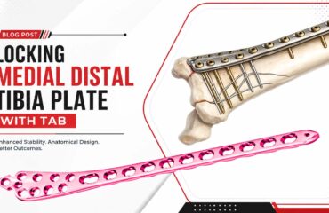 Locking Medial Distal Tibia Plate with Tab 1 Locking Medial Distal Tibia Plate with Tab