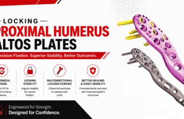 Why Choose Locking Proximal Humerus Altos Plates Locking Proximal Humerus Altos Plates