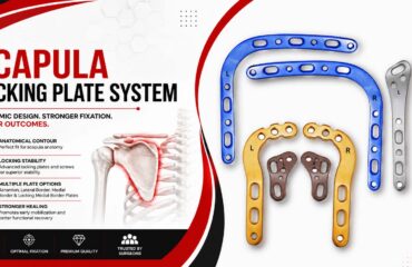 Scapula Locking Plates